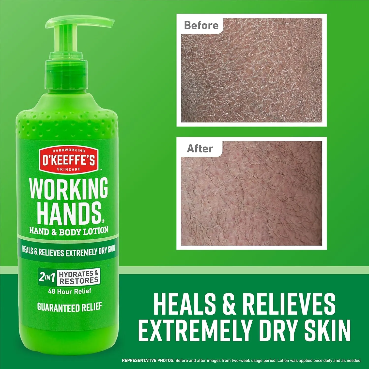 Working Hands Hand and Body Lotion, 12Oz Pump (Pack of 1) - Heals and Relieves Extremely Dry Skin